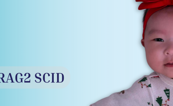 Meet Stella RAG2 SCID